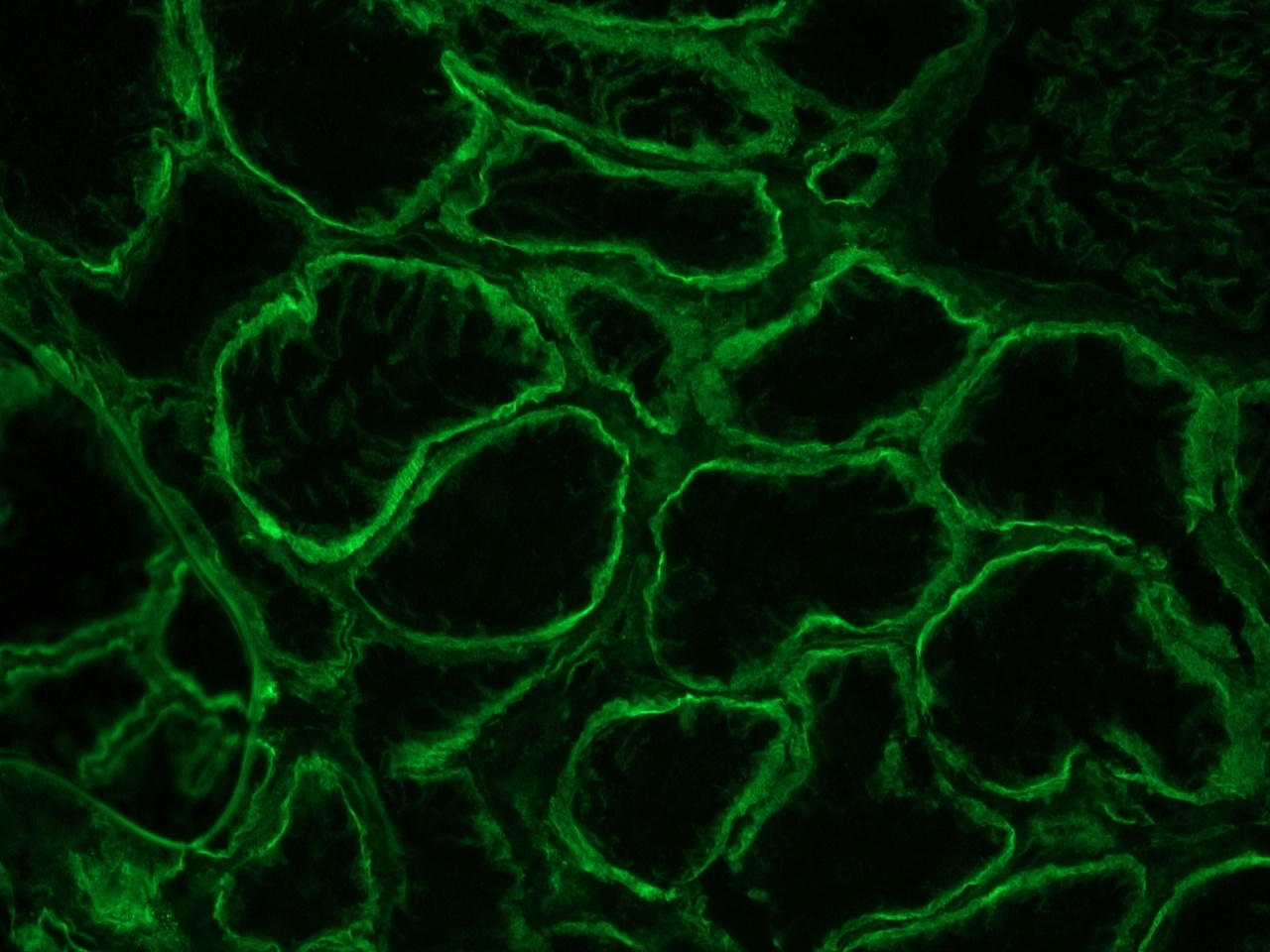 Figure 3: Integrin alpha 6A immunostaining of the basolateral membrane of epithelial cells in a frozen section of human kidney using MUB0908P.